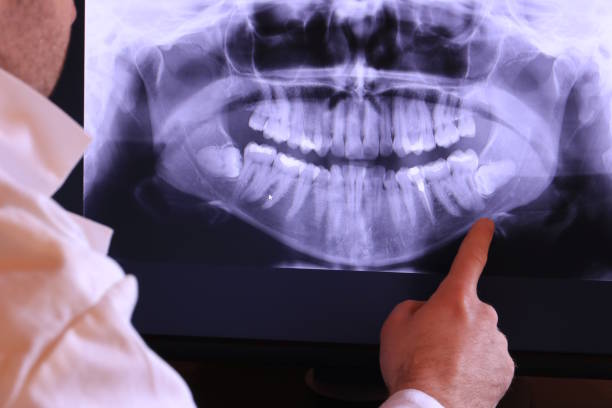 Best Emergency Broken Tooth Repair in Wink, TX