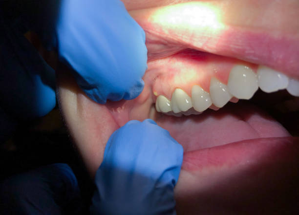 Best Emergency Treatment for Toothache in Wink, TX