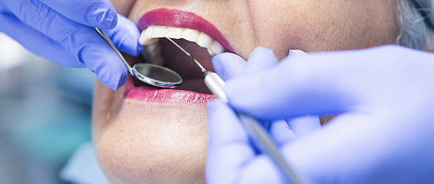 Best Emergency Tooth Extraction in Wink, TX